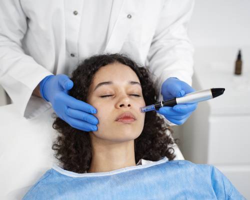 Microneedling