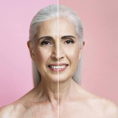 Anti-Aging 