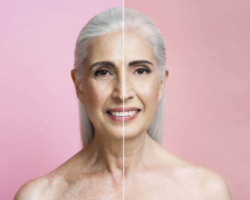 Anti-Aging 